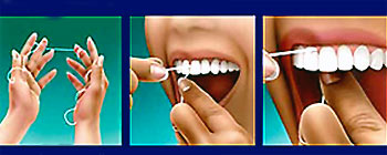 Chải răng đúng cách và dùng chỉ tơ nha khoa ảnh 2